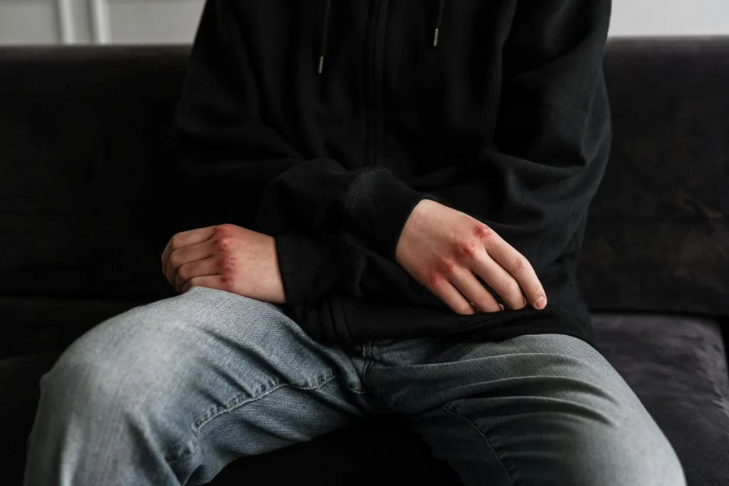 self defence in domestic violence cases faqs